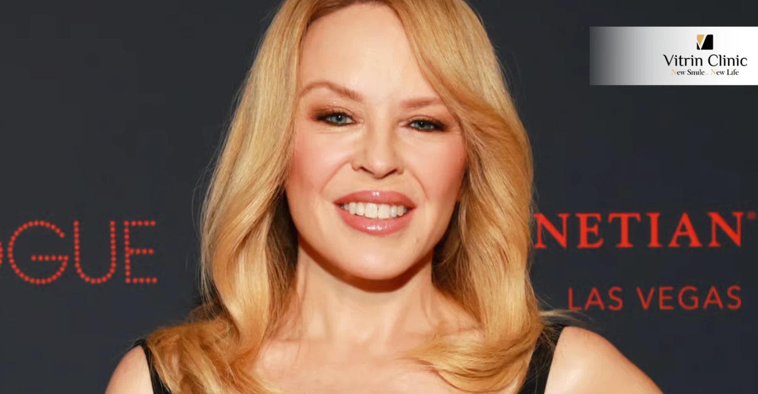 Why is Kylie Minogue smile so captivating?